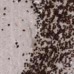 PARP1 Monoclonal Antibody (CL2209)