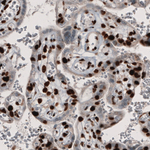 PARP1 Antibody in Immunohistochemistry (Paraffin) (IHC (P))