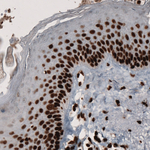 PARP1 Antibody in Immunohistochemistry (Paraffin) (IHC (P))