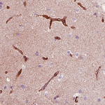 Nestin Antibody in Immunohistochemistry (Paraffin) (IHC (P))