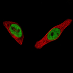 Estrogen Receptor alpha Monoclonal Antibody (CL1196)