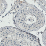 Estrogen Receptor alpha Antibody in Immunohistochemistry (Paraffin) (IHC (P))