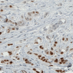 Estrogen Receptor alpha Antibody in Immunohistochemistry (Paraffin) (IHC (P))
