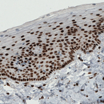 Estrogen Receptor alpha Antibody in Immunohistochemistry (Paraffin) (IHC (P))