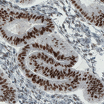 Estrogen Receptor alpha Antibody in Immunohistochemistry (Paraffin) (IHC (P))
