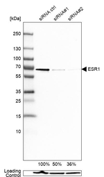Estrogen Receptor alpha Antibody in Western Blot (WB)