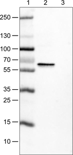 Estrogen Receptor alpha Antibody in Western Blot (WB)