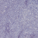 SOX11 Antibody in Immunohistochemistry (Paraffin) (IHC (P))