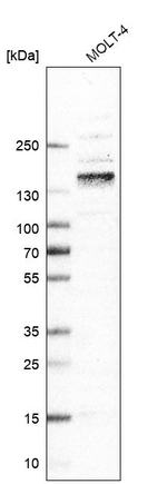 ITGA4 Antibody in Western Blot (WB)