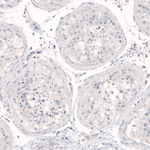 Nanog Antibody in Immunohistochemistry (Paraffin) (IHC (P))