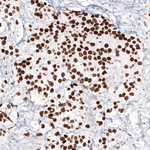 Nanog Antibody in Immunohistochemistry (Paraffin) (IHC (P))