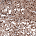 CDK4 Antibody in Immunohistochemistry (Paraffin) (IHC (P))