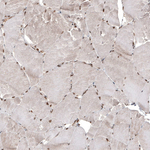 CDK4 Antibody in Immunohistochemistry (Paraffin) (IHC (P))