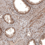 CDK4 Antibody in Immunohistochemistry (Paraffin) (IHC (P))