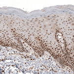 CDK4 Antibody in Immunohistochemistry (Paraffin) (IHC (P))