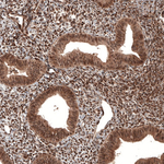 CDK4 Antibody in Immunohistochemistry (Paraffin) (IHC (P))