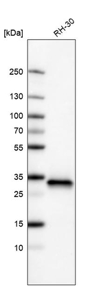 CDK4 Antibody in Western Blot (WB)