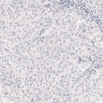 Nanog Antibody in Immunohistochemistry (Paraffin) (IHC (P))