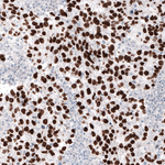 Nanog Antibody in Immunohistochemistry (Paraffin) (IHC (P))