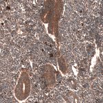 YAP1 Antibody in Immunohistochemistry (Paraffin) (IHC (P))