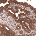 YAP1 Antibody in Immunohistochemistry (Paraffin) (IHC (P))