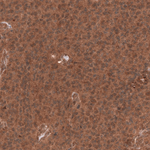 YAP1 Antibody in Immunohistochemistry (Paraffin) (IHC (P))