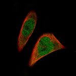 SOX11 Monoclonal Antibody (CL0142)