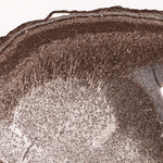 SOX11 Antibody in Immunohistochemistry (Paraffin) (IHC (P))