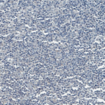 SOX11 Antibody in Immunohistochemistry (Paraffin) (IHC (P))
