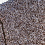 SOX11 Antibody in Immunohistochemistry (Paraffin) (IHC (P))