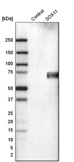SOX11 Antibody in Western Blot (WB)