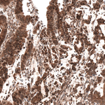 SMAD4 Antibody in Immunohistochemistry (Paraffin) (IHC (P))
