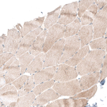 SMAD4 Antibody in Immunohistochemistry (Paraffin) (IHC (P))