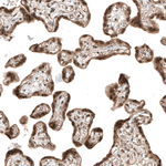 SMAD4 Antibody in Immunohistochemistry (Paraffin) (IHC (P))