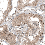 SMAD4 Monoclonal Antibody (CL9774)