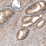 SMAD4 Antibody in Immunohistochemistry (Paraffin) (IHC (P))