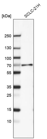SMAD4 Antibody in Western Blot (WB)