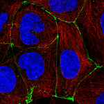 Occludin Monoclonal Antibody (CL1567)