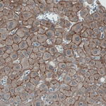 Occludin Antibody in Immunohistochemistry (Paraffin) (IHC (P))