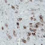 Occludin Antibody in Immunohistochemistry (Paraffin) (IHC (P))