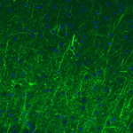 NEFM Antibody in Immunohistochemistry (Paraffin) (IHC (P))