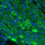 NEFM Antibody in Immunohistochemistry (Paraffin) (IHC (P))