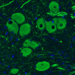 NEFM Monoclonal Antibody (CL2678)