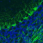 NEFM Antibody in Immunohistochemistry (Paraffin) (IHC (P))