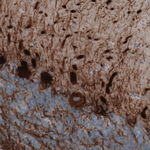 NEFM Antibody in Immunohistochemistry (Paraffin) (IHC (P))