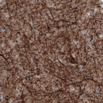 NEFM Antibody in Immunohistochemistry (Paraffin) (IHC (P))