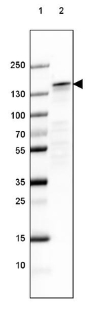 NEFM Antibody in Western Blot (WB)