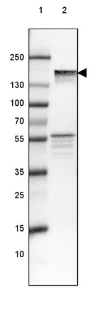 NEFM Antibody in Western Blot (WB)
