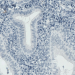 MMP9 Antibody in Immunohistochemistry (Paraffin) (IHC (P))