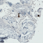 MMP9 Antibody in Immunohistochemistry (Paraffin) (IHC (P))